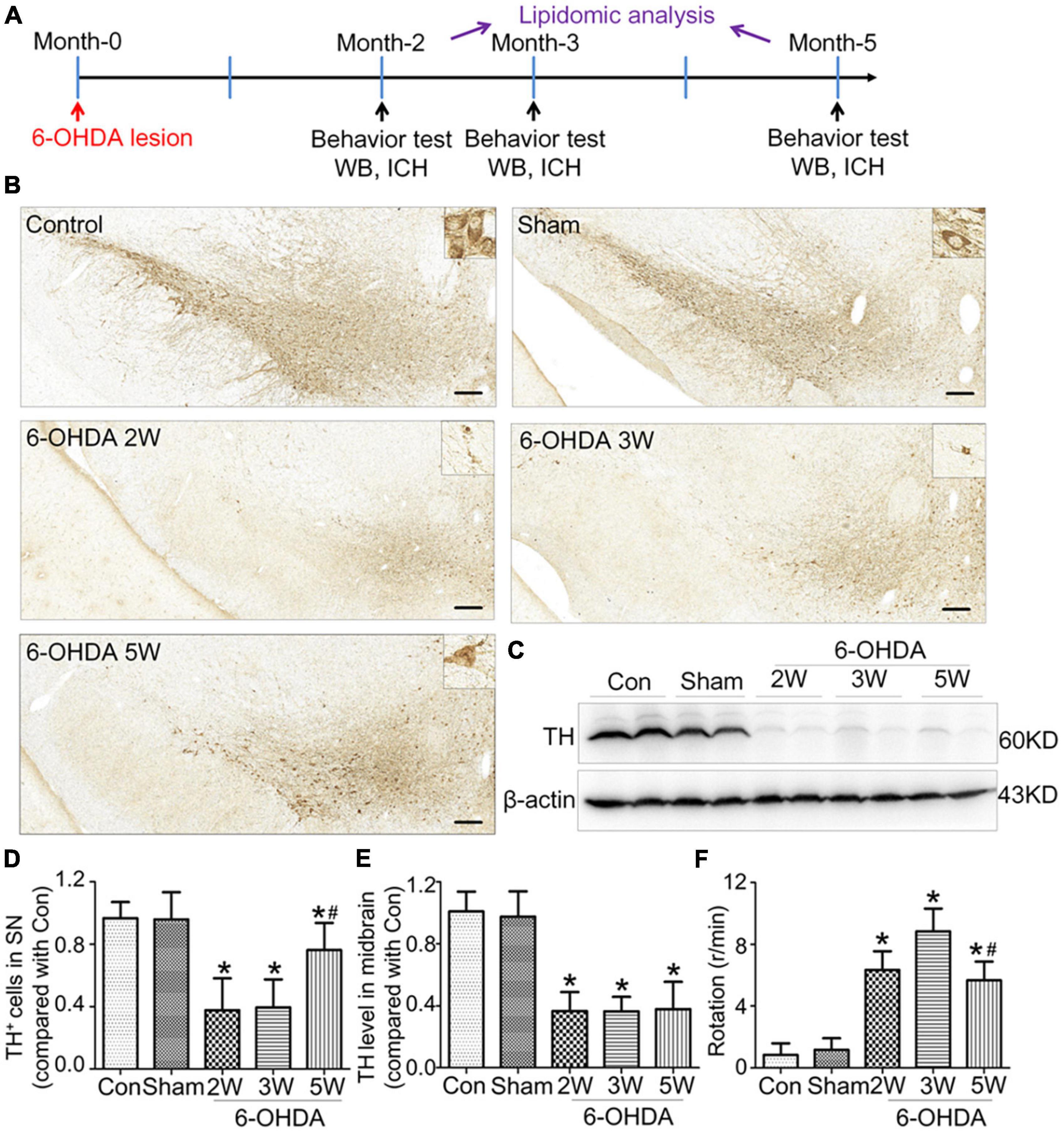 Lipid profiles in the cerebrospinal fluid of rats with 6-hydroxydopamine-induced lesions as a model of Parkinson’s disease